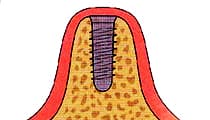 GBRæ³ éªšé æåŸ